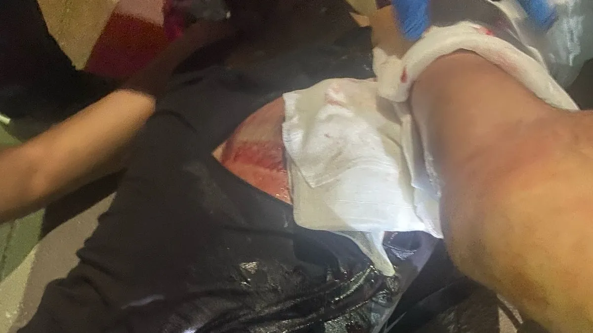 Trafikte “Neden baktın” kavgası! Motosikletli, otomobil sürücüsünü bıçakladı